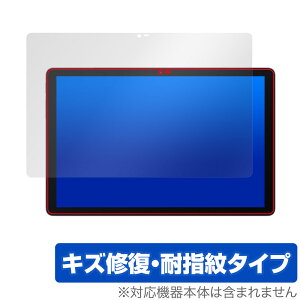 Blackview Tab 10 WiFi �ی� �t�B���� OverLay Magic �u���b�N�r���[ �^�u���b�g�p�ی�t�B���� �t���ی� ���C�� �ώw�� �w��h�~