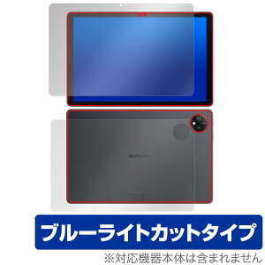 Blackview Tab 10 WiFi \ w tB OverLay Eye Protector ^ubgpیtB \ʁEwʃZbg u[CgJbg