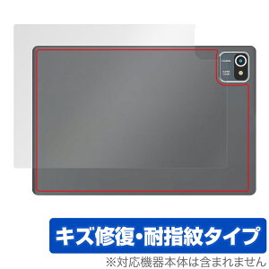 HiGrace MB1001 �w�� �ی� �t�B���� OverLay Magic HiGraceMB1001 �^�u���b�g�p�ی�t�B���� �{�̕ی� ���C�� �w��h�~ �R�[�e�B���O