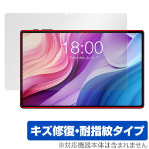 Teclast T40HD ی tB OverLay Magic eNXg ^ubgpیtB tی C ώw wh~ R[eBO