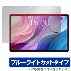 Teclast T40HD ی tB OverLay Eye Protector eNXg ^ubgpیtB tی ڂɗD u[CgJbg