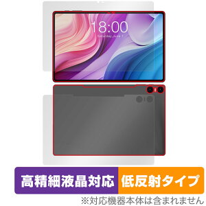 Teclast T40HD \ w Zbg یtB OverLay Plus Lite eNXg ^ubgptB ׉tΉ A`OA ᔽ