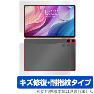 Teclast T40HD \ w tB OverLay Magic eNXg ^ubgpیtB \ʁEwʃZbg C ώw wh~