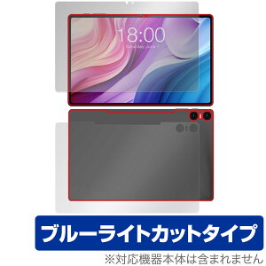 Teclast T40HD \ w tB OverLay Eye Protector eNXg ^ubgpیtB \ʁEwʃZbg u[CgJbg