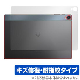 HEADWOLF HPad 5 背面 保護 フィルム OverLay Magic HEADWOLFHPad5 タブレット用保護フィルム 本体保護 傷修復 指紋防止 コーティング