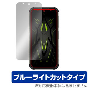 Ulefone Armor 22 �ی� �t�B���� OverLay Eye Protector �E���t�H�� �A�[�}�[ 22 �X�}�z�p�ی�t�B���� �t���ی� �u���[���C�g�J�b�g