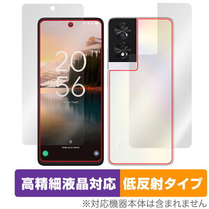 TCL 40 NXTPAPER \ w tB OverLay Plus Lite TCL X}zpیtB \ʁEwʃZbg ׉tΉ A`OA ᔽ