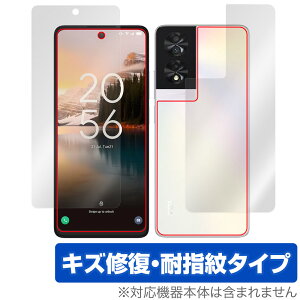 TCL 40 NXTPAPER \ w tB OverLay Magic TCL X}z X}[gtHpیtB \ʁEwʃZbg C ώw wh~