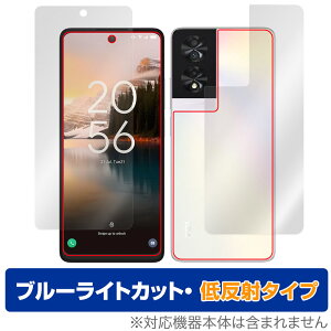 TCL 40 NXTPAPER \ w tB OverLay Eye Protector ᔽ TCL X}zpیtB \ʁEwʃZbg u[CgJbg