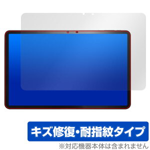 AvidPad A90 ی tB OverLay Magic Arhpbh A90 ^ubgpیtB tی C ώw wh~ R[eBO