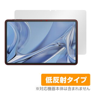 DOOGEE T20 Ultra ی tB OverLay Plus hD[W[ ^ubgpیtB tی A`OA ˖h~  wh~