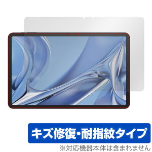 DOOGEE T20 Ultra ی tB OverLay Magic hD[W[ ^ubgpیtB tی C ώw wh~ R[eBO