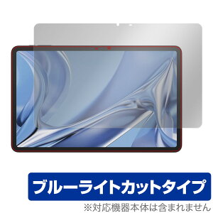 DOOGEE T20 Ultra ی tB OverLay Eye Protector hD[W[ ^ubgpیtB tی ڂɗD u[CgJbg