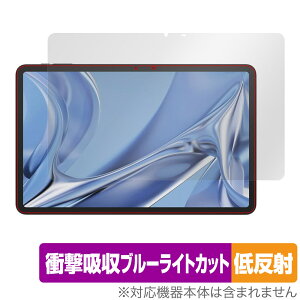 DOOGEE T20 Ultra ی tB OverLay Absorber ᔽ hD[W[ ^ubgpیtB Ռz u[CgJbg R