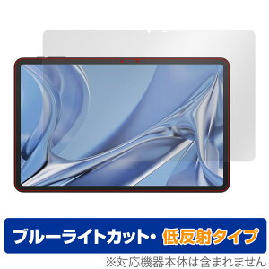 DOOGEE T20 Ultra یtB OverLay Eye Protector ᔽ hD[W[ ^ubgptB tی u[CgJbg ˖h~