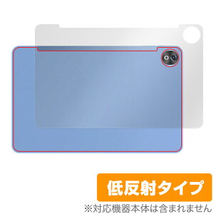 DOOGEE T20 Ultra w ی tB OverLay Plus hD[W[ ^ubgpیtB {̕ی 炳G ᔽˑf