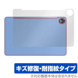 DOOGEE T20 Ultra w ی tB OverLay Magic hD[W[ ^ubgpیtB {̕ی C wh~ R[eBO