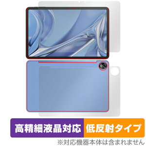 DOOGEE T20 Ultra \ w Zbg یtB OverLay Plus Lite hD[W[ ^ubgp ׉tΉ A`OA ˖h~