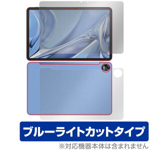 DOOGEE T20 Ultra \ w tB OverLay Eye Protector hD[W[ ^ubgpیtB \ʁEwʃZbg u[CgJbg