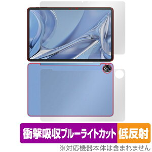 DOOGEE T20 Ultra \ w tB OverLay Absorber ᔽ hD[W[ ^ubgpیtB \ʁEwʃZbg Ռz R