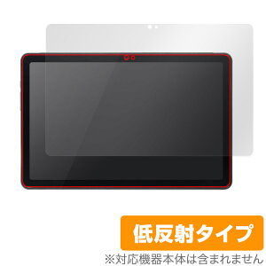 qPad DX KP13-NV ی tB OverLay Plus NG pbh p^ubgptB tی A`OA ˖h~