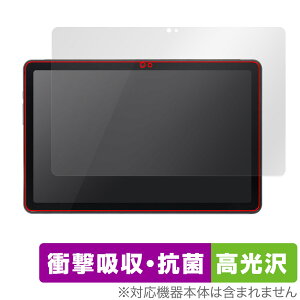 qPad DX KP13-NV ی tB OverLay Absorber  NG pbh p^ubg Ռz R
