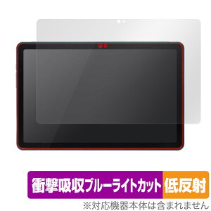 qPad DX KP13-NV ی tB OverLay Absorber ᔽ NG pbh p^ubg Ռz u[CgJbg R