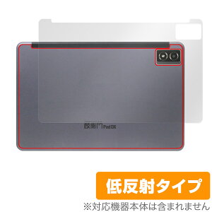 qPad DX KP13-NV w ی tB OverLay Plus NG pbh p^ubgptB 炳G ᔽˑf