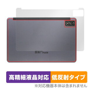 qPad DX KP13-NV w ی tB OverLay Plus Lite NG pbh p^ubgptB 炳G ᔽ