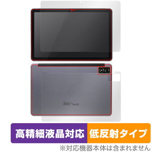 qPad DX KP13-NV \ w Zbg یtB OverLay Plus Lite p^ubg ׉tΉ A`OA ˖h~