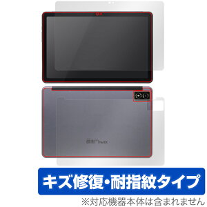 qPad DX KP13-NV \ w tB OverLay Magic NG pbh p^ubg \ʁEwʃZbg C wh~