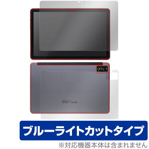 qPad DX KP13-NV \ w tB OverLay Eye Protector NG p^ubg \ʁEwʃZbg u[CgJbg