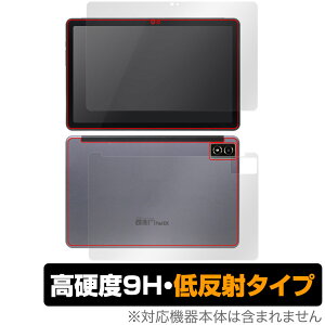 qPad DX KP13-NV \ w tB OverLay 9H Plus NG pbh p^ubg \ʁEwʃZbg 9Hdx ˖h~