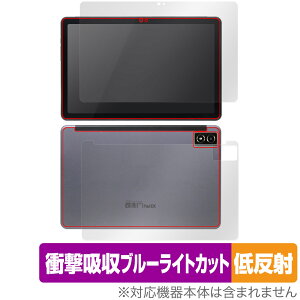 qPad DX KP13-NV \ w tB OverLay Absorber ᔽ NG \ʁEwʃZbg Ռz u[CgJbg R