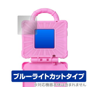 ǂԂ킪`ՂI߂Ă킵 LjRgN ی tB OverLay Eye Protector tی u[CgJbg