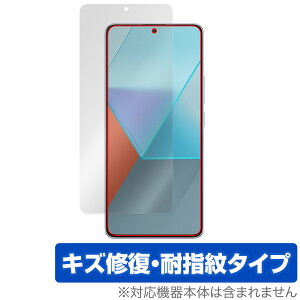 Xiaomi Redmi Note 13 Pro 5G ی tB OverLay Magic VI~[ h~ m[g X}zpیtB tی C wh~