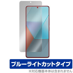 Xiaomi Redmi Note 13 Pro 5G یtB OverLay Eye Protector VI~[ X}zptB tی ڂɗD u[CgJbg
