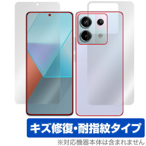 Xiaomi Redmi Note 13 Pro 5G \ w tB OverLay Magic VI~[ X}zpیtB \ʁEwʃZbg C wh~