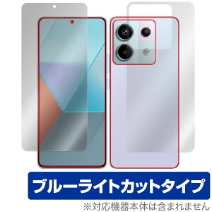 Xiaomi Redmi Note 13 Pro 5G \ w tB OverLay Eye Protector X}zpیtB \ʁEwʃZbg u[CgJbg
