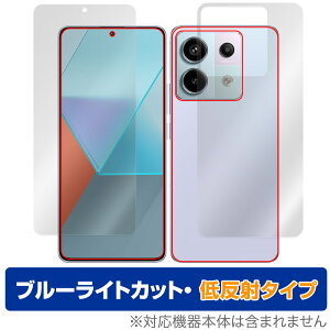 Xiaomi Redmi Note 13 Pro 5G \ w tB OverLay Eye Protector ᔽ X}zp \ʁEwʃZbg u[CgJbg ˖h~