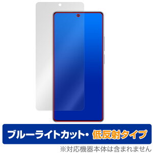 Xiaomi Redmi Note 13 Pro 4G یtB OverLay Eye Protector ᔽ VI~[ X}zptB u[CgJbg ˖h~