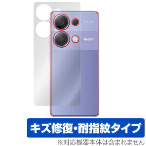 Xiaomi Redmi Note 13 Pro 4G w ی tB OverLay Magic VI~[ X}zpیtB {̕ی C wh~