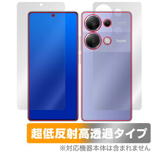 Xiaomi Redmi Note 13 Pro 4G \ w tB OverLay Plus Premium VI~[ X}zp \ʁEwʃZbg A`OA ˖h~