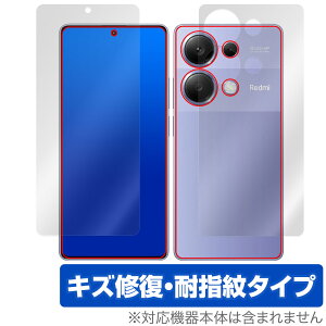 Xiaomi Redmi Note 13 Pro 4G \ w Zbg یtB OverLay Magic VI~[ X}zpیtB C wh~