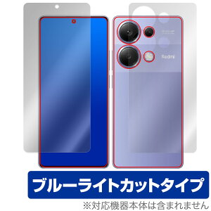 Xiaomi Redmi Note 13 Pro 4G \ w tB OverLay Eye Protector VI~[ X}zp \ʁEwʃZbg u[CgJbg