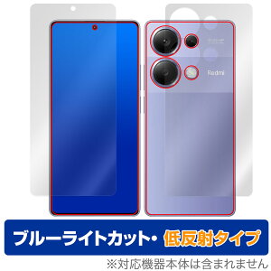 Xiaomi Redmi Note 13 Pro 4G \ w Zbg یtB OverLay Eye Protector ᔽ VI~[ X}zp u[CgJbg