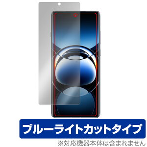 OPPO Find X7 Ultra ی tB OverLay Eye Protector Ib| X}zpیtB tی ڂɗD u[CgJbg