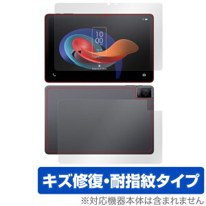 TCL TAB 10 Gen 2 8496G1 \ w tB OverLay Magic for TCL ^ubg \ʁEwʃZbg C ώw wh~ R[eBO