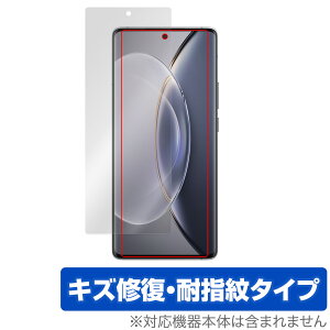 vivo X90 Pro �ی� �t�B���� OverLay Magic ���B�[���H �X�}�z�p�ی�t�B���� �t���ی� ���C�� �ώw�� �w��h�~ �R�[�e�B���O