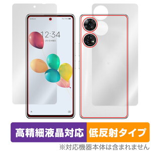 񂵂t@~[X}z ݂R炵X}z \ w Zbg یtB OverLay Plus Lite ׉tΉ A`OA ᔽ